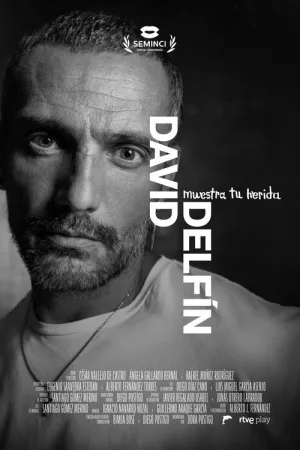 david دل فین، نمایش زخم تو