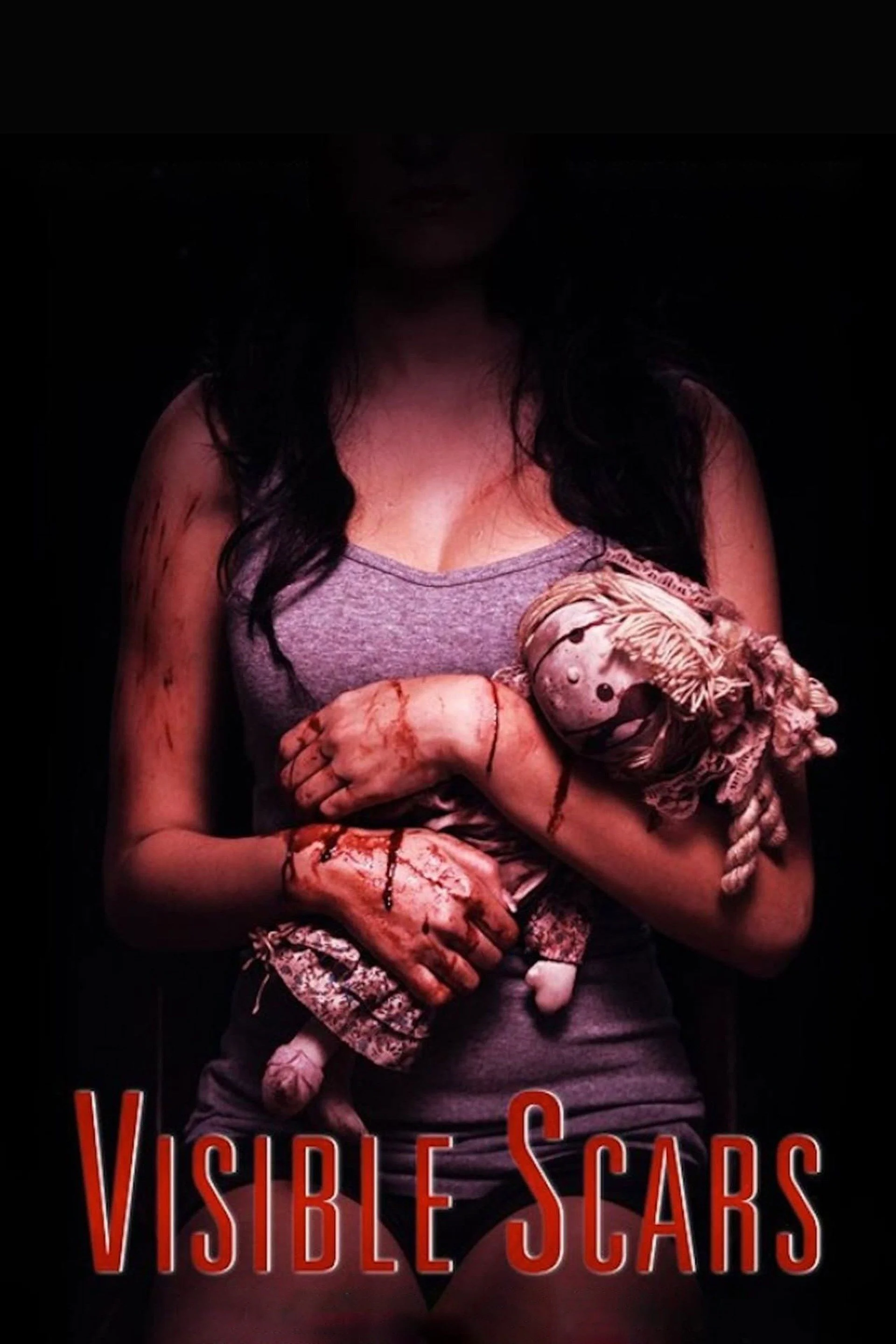 زخم‌های قابل مشاهده