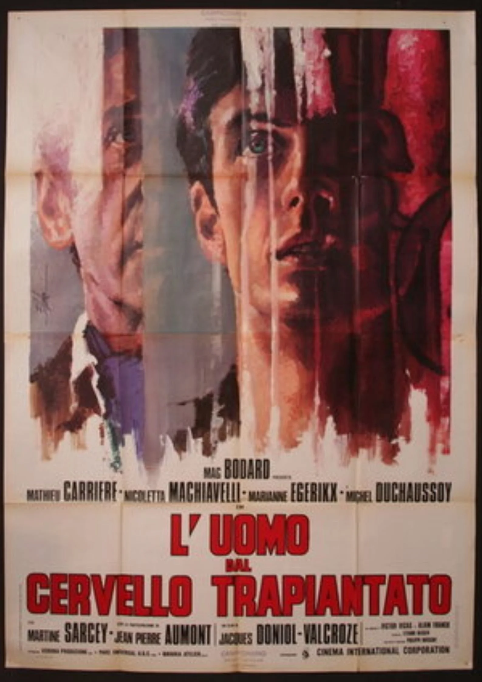 مردی با مغز پیوندی