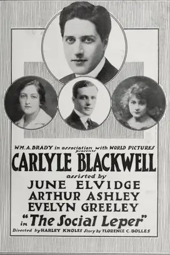 جزام اجتماعی